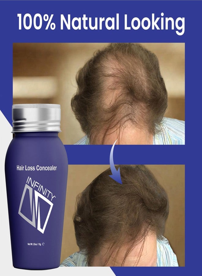 إينفينيتي ألياف إنفينيتي السوداء للشعر الخفيف للنساء والرجال - بودرة ألياف بناء الشعر غير مرئية بنسبة 100% - تخفي تساقط الشعر في 15 ثانية، 30 غرام - Image 5